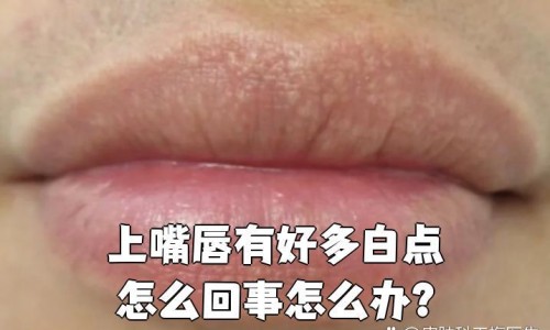 月经期间可以吃龟苓膏吗